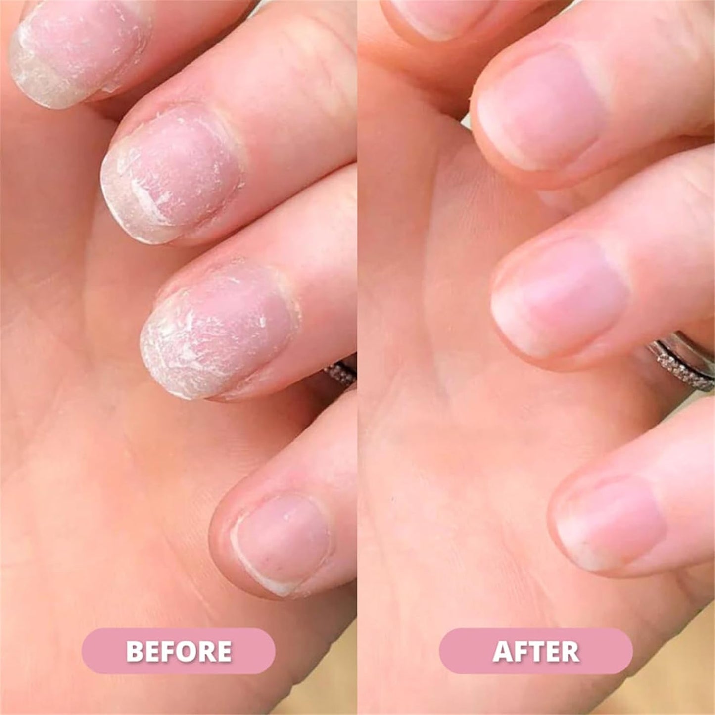 PureGlow Nail Pen